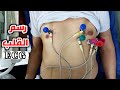 شاهد ازاي بنعمل رسم القلب تطبيق عملي How To Record 12 Lead ECG Electrocardiogram شاهد ازاي بنعمل رسم القلب تطبيق عملي How To Record 12 Lead ECG Electrocardiogram