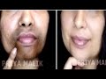 Remove Dark Black patches, Dark Spots, Hyper pigmentation Around Your Mouth