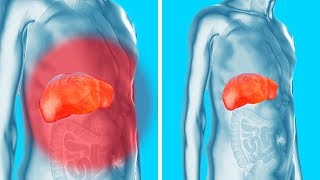 Remove Toxins from Your Kidneys, Liver and Bladder Gently Yet Effectively