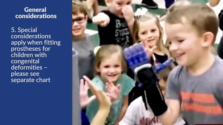 Amputations and Prosthetics| Study Prep for passing the NBCOT® Exam | Pass the OT