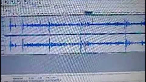 ITC Artificial and Natural Voice Response