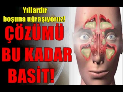 ÇÖZÜMÜ BU KADAR BASİT