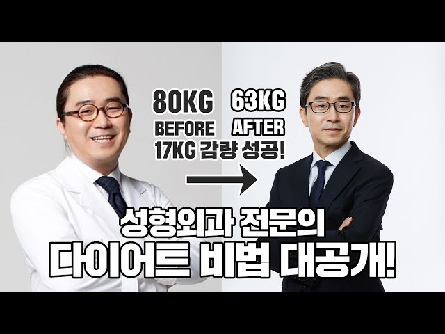 성형외과 전문의 다이어트 비법 대공개!!(17kg 감량!)