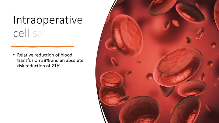 Post partum haemorrhage - Green top guideline summary for MRCOG part2 exams