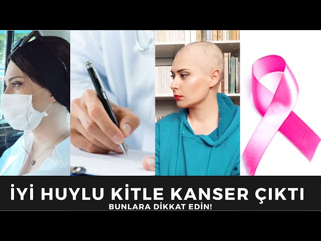 İyi Huylu Kitle Dediler Kanser Olduğumu Öğrendim - Bunlara Dikkat Edin! class=