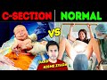 NORMAL DELIVERY vs. C-SECTION - कौनसा बेहतर है? | Science Behind Medical Delivery Procedures