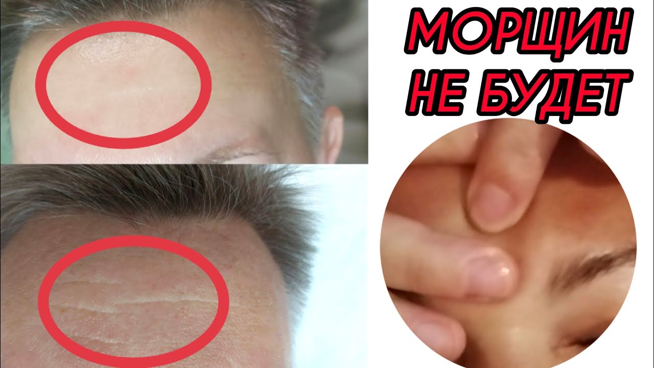 Делай эти техники массажа и морщин не будет #классическиймассаж #массаж #массажтела #массажлица 