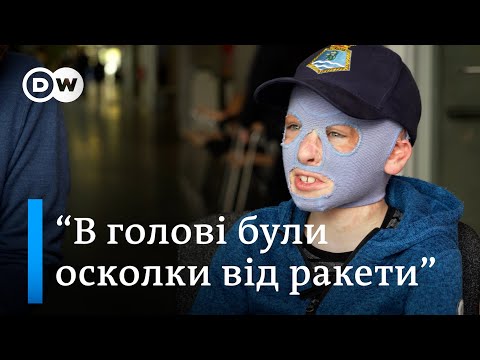 Як у Німеччині лікують хлопчика, який отримав важкі опіки після удару по Вінниці - DW Ukrainian.