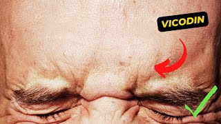 Understanding the Risks and Benefits of Vicodin