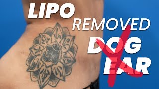 Can Dog Ears From A Tummy Tuck Be Removed?