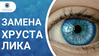 Замена хрусталика глаза при катаракте