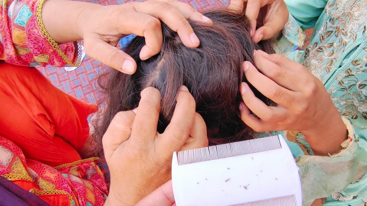 short hairs full of lices and nits #ASMRSajida