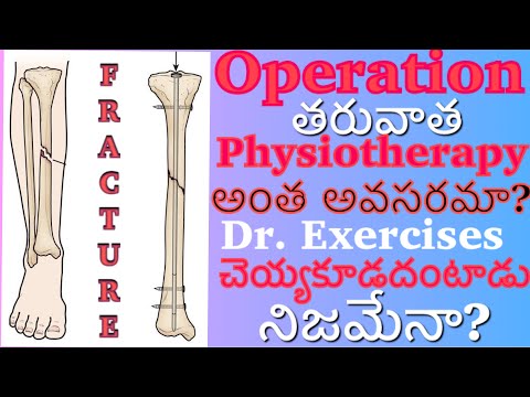 ఫ్రాక్చర్ (ఎముక విరగడం) | ఎముక పగులు తర్వాత ఫిజియోథెరపీ bone fracture by Dr. Satya