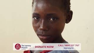 Make ending leprosy your legacy