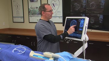 ACIST U - HDi Area and Diameter