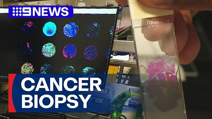 Researchers' world-first breakthrough on profiling cancer tissue | 9 News Australia