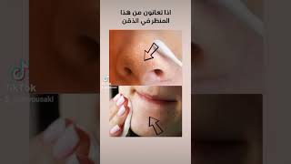 التخلص نهائيا من الرؤوس البيضاء #conseil #skincare #الصحة_والجمال #beauty #explore