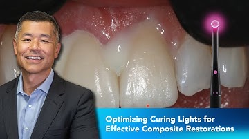 Optimizing Curing Lights for Effective Composite Restorations | Dentist 2 Dentist