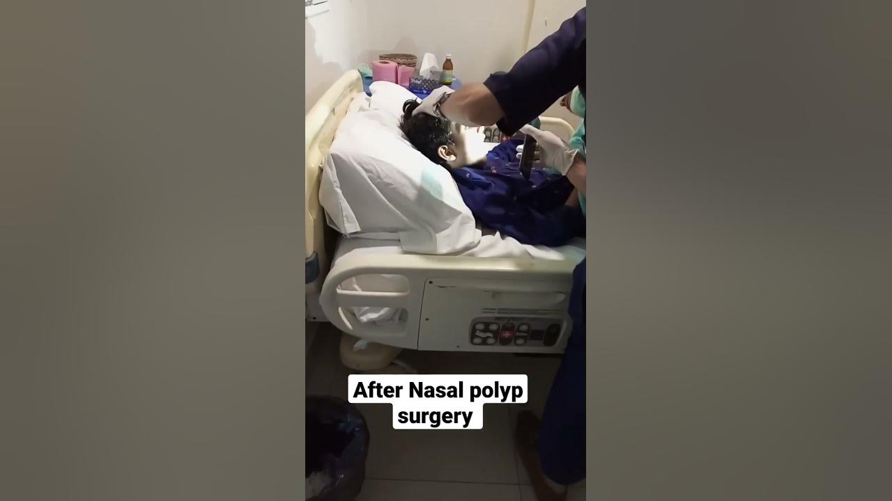 after-nasal-polyp-surgery-polyppectomy-viralreels-trending-viral