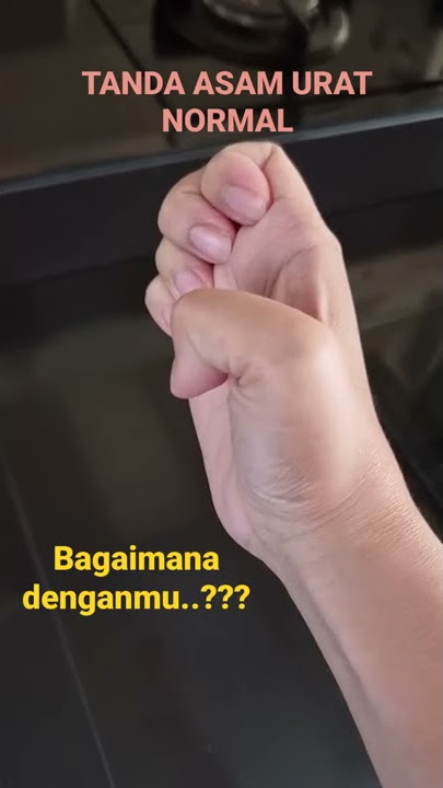 TANDA ASAM URAT NORMAL DARI TANGAN