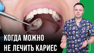 Когда можно не лечить кариес или хотя бы не сверлить. Лечение кариеса.