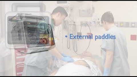 Manual Defibrillation with the Efficia DFM100 monitor/defibrillator