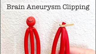 Playdough Surgery 🔪🧠🍒 - Brain Aneurysm Clipping
