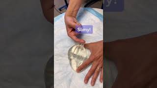 What Happens When You Touch The Inside Of A Silicone Implant