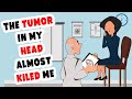 I Started Acting Strange To My FAMILY And Friends  Because Of A BRAIN TUMOR |Animated Story