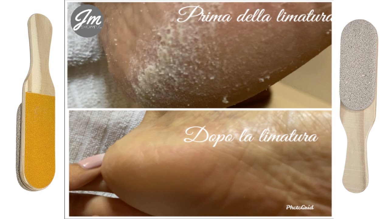 Come fare il PEDICURE Perfetto a Casa Senza fare Danni rimuovendo Duroni e Calli con Jania