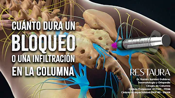 ¿Cuánto dura un bloqueo medular?