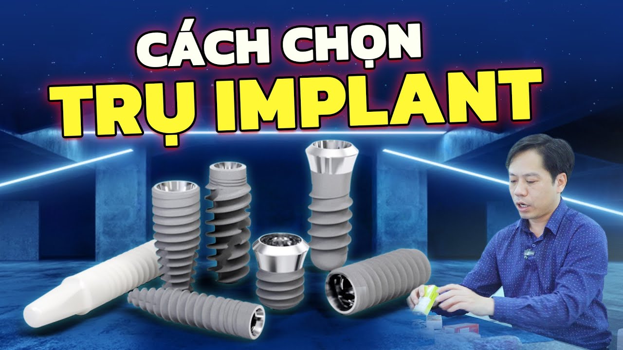 Outline Video Nên Chọn Trụ Implant Nào? Top 7+ Trụ Implant Được Lạc Việt Intech "Tuyển Chọn" Kèm Giá Chi Tiết