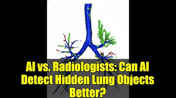 AI vs. Radiologists: Can AI Detect Hidden Lung Objects Better?