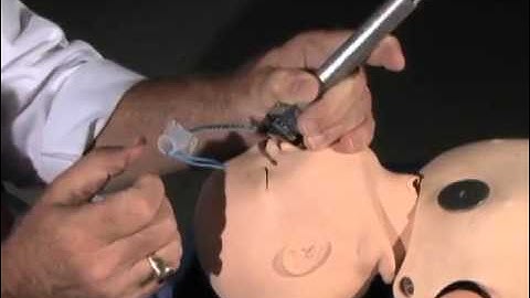 Pediatric Intubation