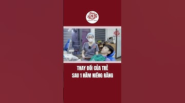 Sự Thay Đổi Của Trẻ Sau 1 Năm Niềng Răng #short