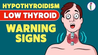 Signs that you have a Low Thyroid Level | Hypothyroidism - Signs \& Symptoms | Thyroid disease