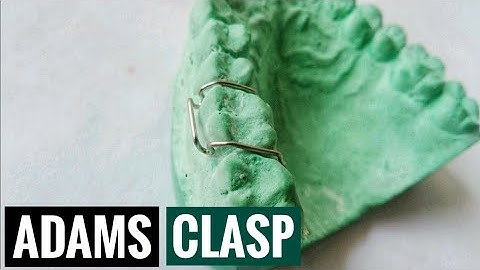 Easy Method Of Adams Clasp/Liverpool Clasp Fabrication | How To Make A Good Adams Clasp Easily