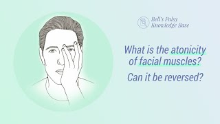 What is the atonicity of facial muscles? Can it be reversed? - Bell&#39;s Palsy Knowledge Base