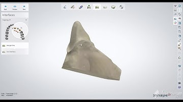 simple coping bridge 3shape