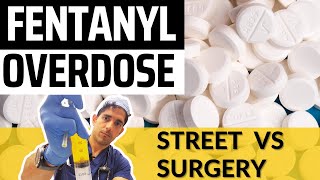 Fentanyl Overdose: Street vs Surgery (and San Francisco Opioid Crisis)