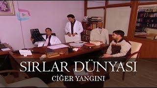 Sırlar Dünyası - Ci̇ğer Yangini
