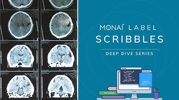 MONAI Label - Scribbles Annotation