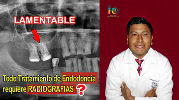¿Puede una radiografía determinar si necesita una endodoncia?