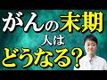 【誰も言わない】がんの末期の真実を話します　大腸がんや、すい臓がんがかなり進むとどうなるか専門医が解説