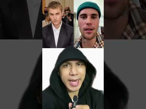 Justin Bieber Và Hội Chứng Gây Liệt Mặt | Điều Thú Vị Có Thể Bạn Chưa Biết | Davo's Lingo #s