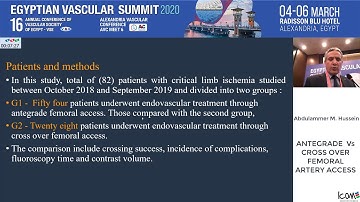 ANTEGRADE  Vs  CROSS OVER  FEMORAL  ARTERY ACCESS