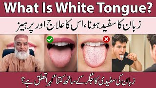 What Is White Tongue? | White Tongue Treatment | Zuban Ka Safed Hona Urdu | Al-Razaqi Health Recover screenshot 5