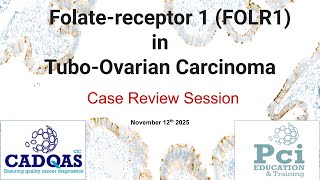 Case Review for PT 1330 - FOLR1 in Tubo-Ovarian Carcinoma 12NOV2025