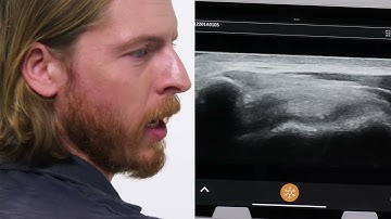 Introducing Clarius Voice Controls for MSK