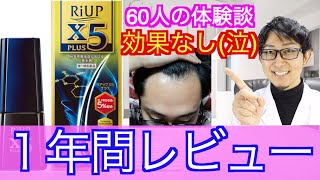 【育毛剤•AGA対策】リアップx5は効果あるの？AGAの60人の体験談を元にリアルガチで解説します